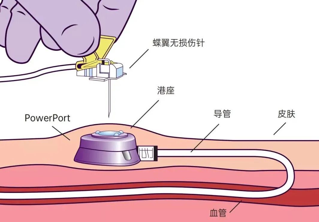 微信圖片_20230412080804.jpg 微信圖片_20230412080804.jpg